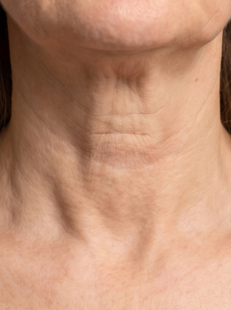 antes-despues 3