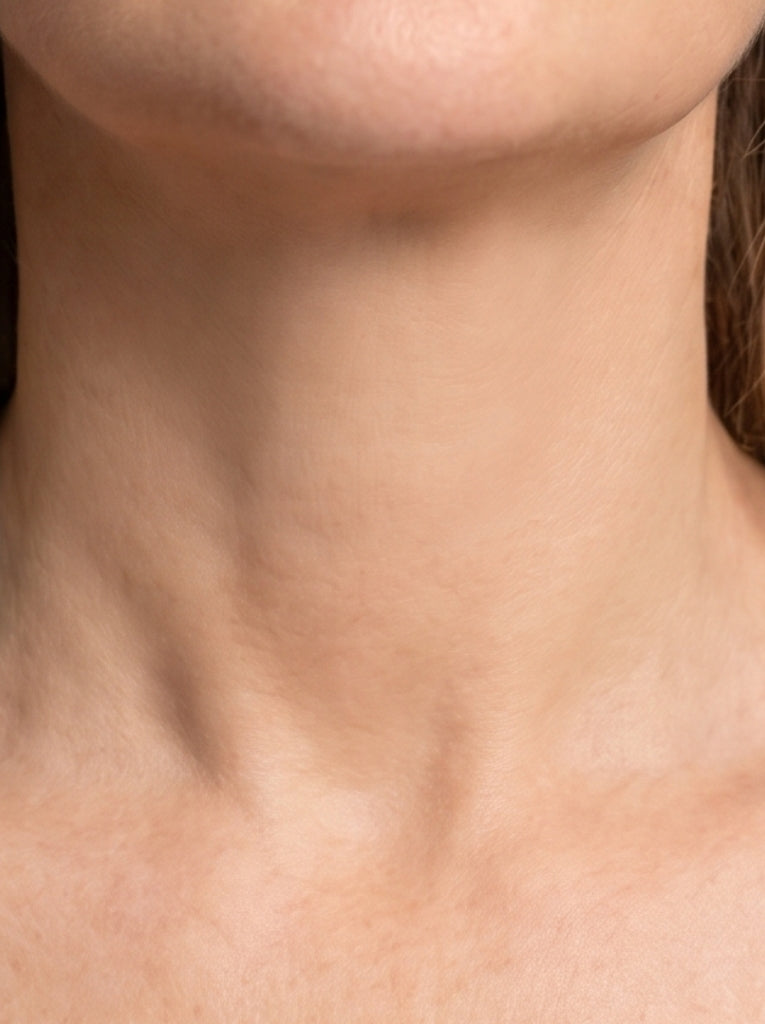 antes-despues 4